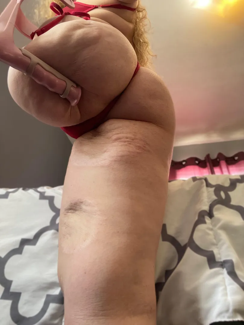 Good morning from your favorite HAG (Hip Amputee Goddess). May your day be finer than my ass