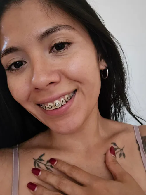 Happy Thursday! Kissing with braces is so nice!