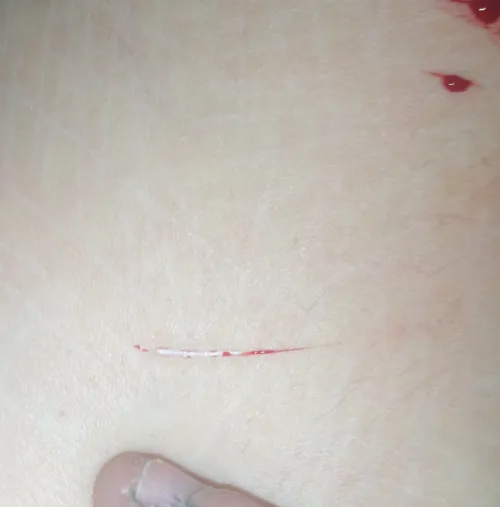 how to care for this? (TW:styro cvt)