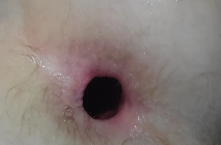 How's my gape ?