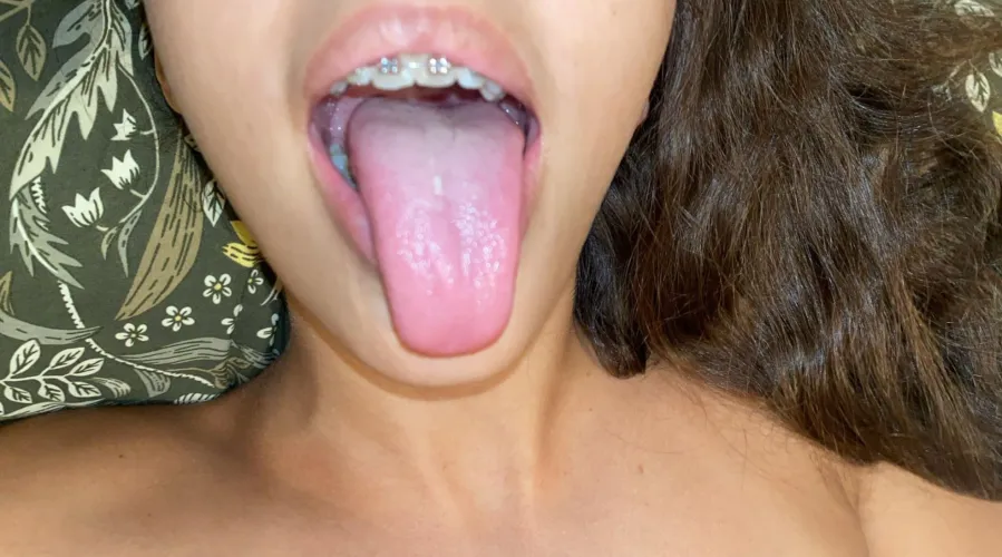 I can say aaah very wide!