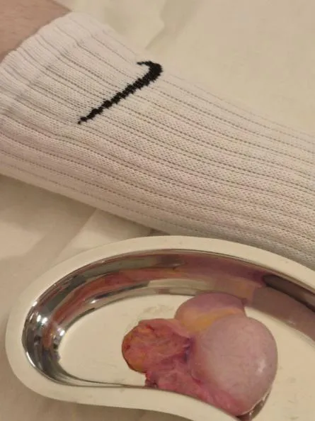 I didn't deserve this bull testicle