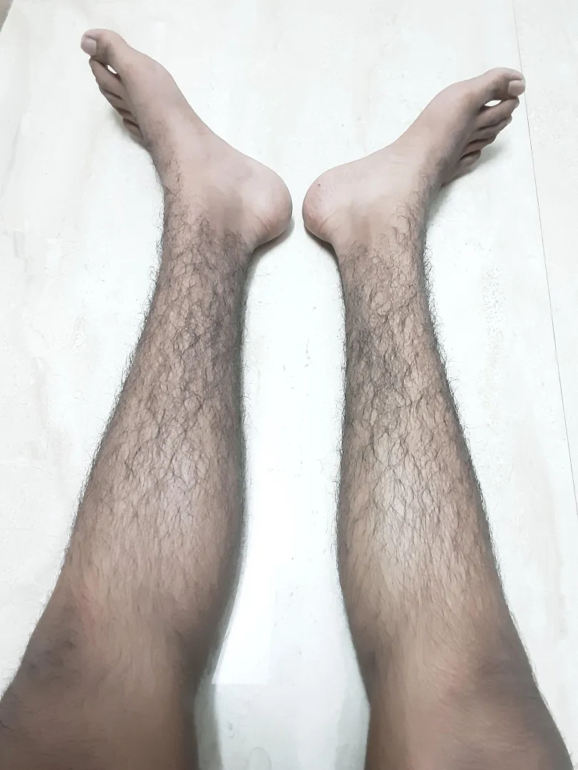 I didn't expect to develop hair on my legs before my arms, face and chest[18 M]...