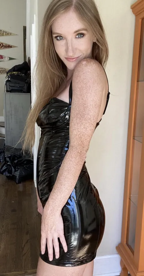 I have more freckles on one arm than most people have all over