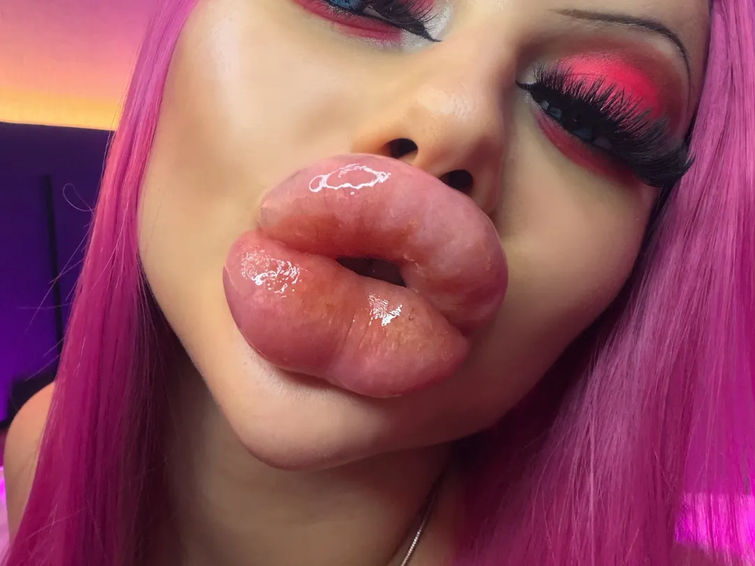 I have the biggest bimbo fake lips on reddit