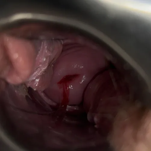 i loooove love love how she’s looking these days  (cw for period blood)