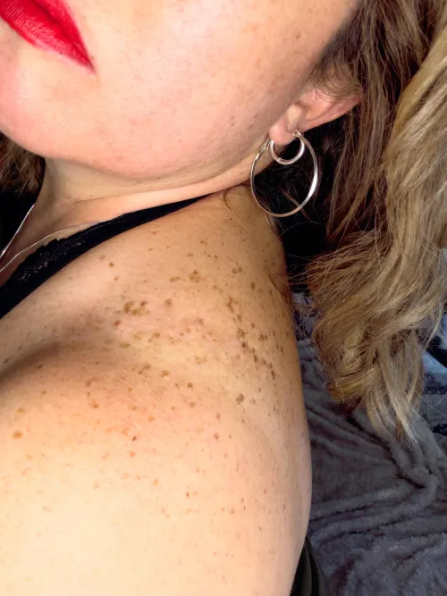 I love my freckles!