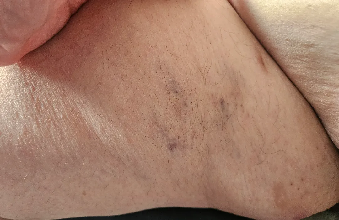 I love to see pretty marks on my inner thighs