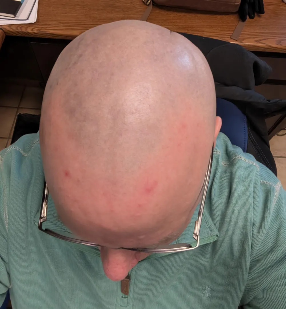 I need cum and piss on my bald head