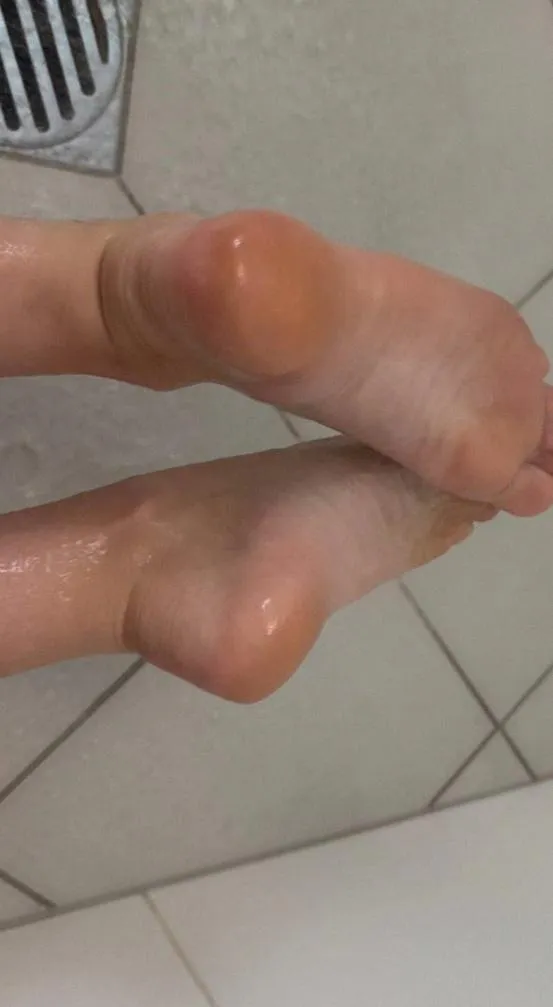 I think you should rub them