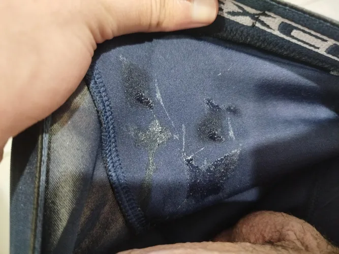 I woke up with my underwear like this.