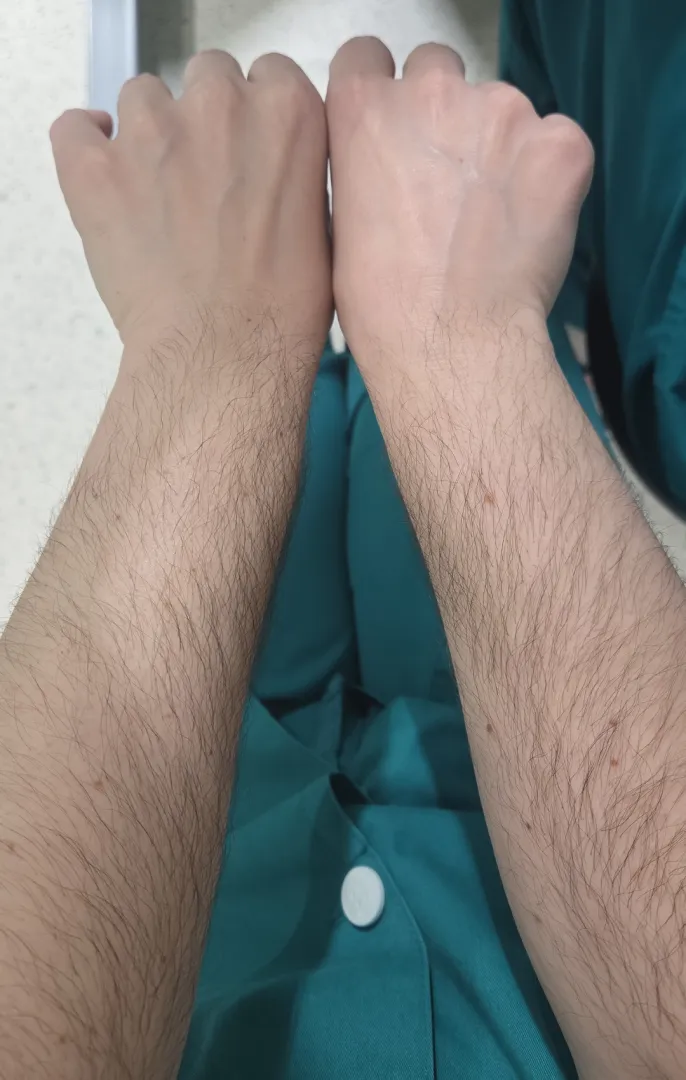 I'm your hairy nurse ❤️ [arms]