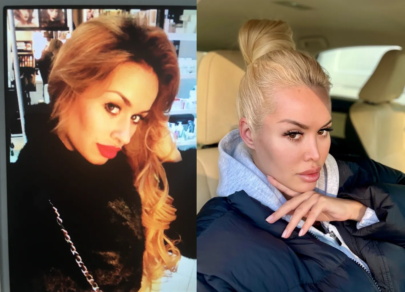 In the my “before” life, I always used lip gloss to make my lips look bigger without fillers