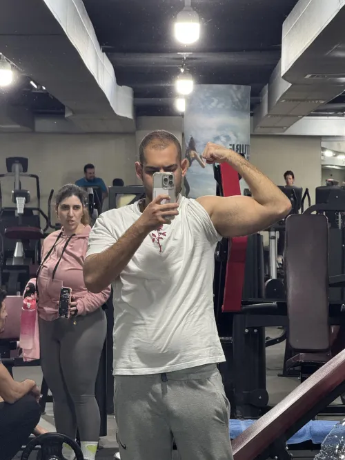 Is it a distracting soft bulge?