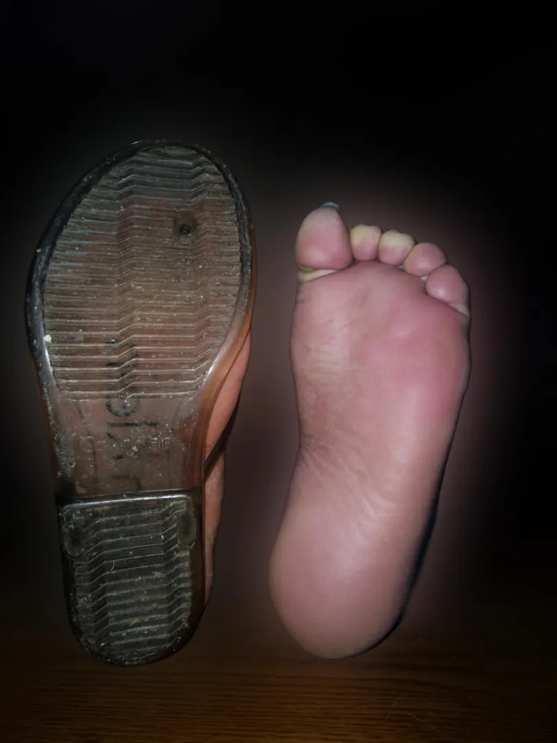 Is it a turn off that my left foot/leg are completely paralyzed and numb?