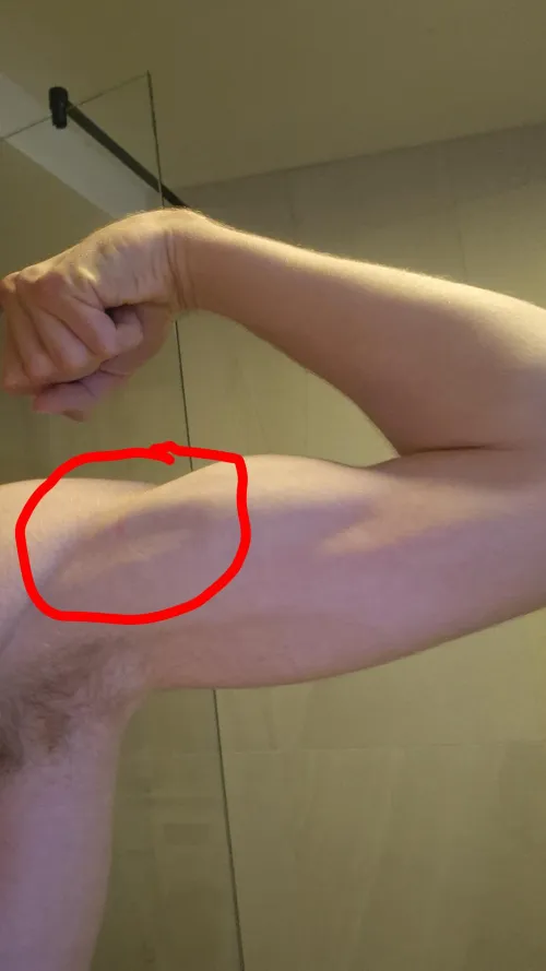 Is this dent on the bicep normal when i flex the muscle or should i be concerned, it is only on my right arm. Might matter but i have been practicing volleyball intensely for a few years and am 18M