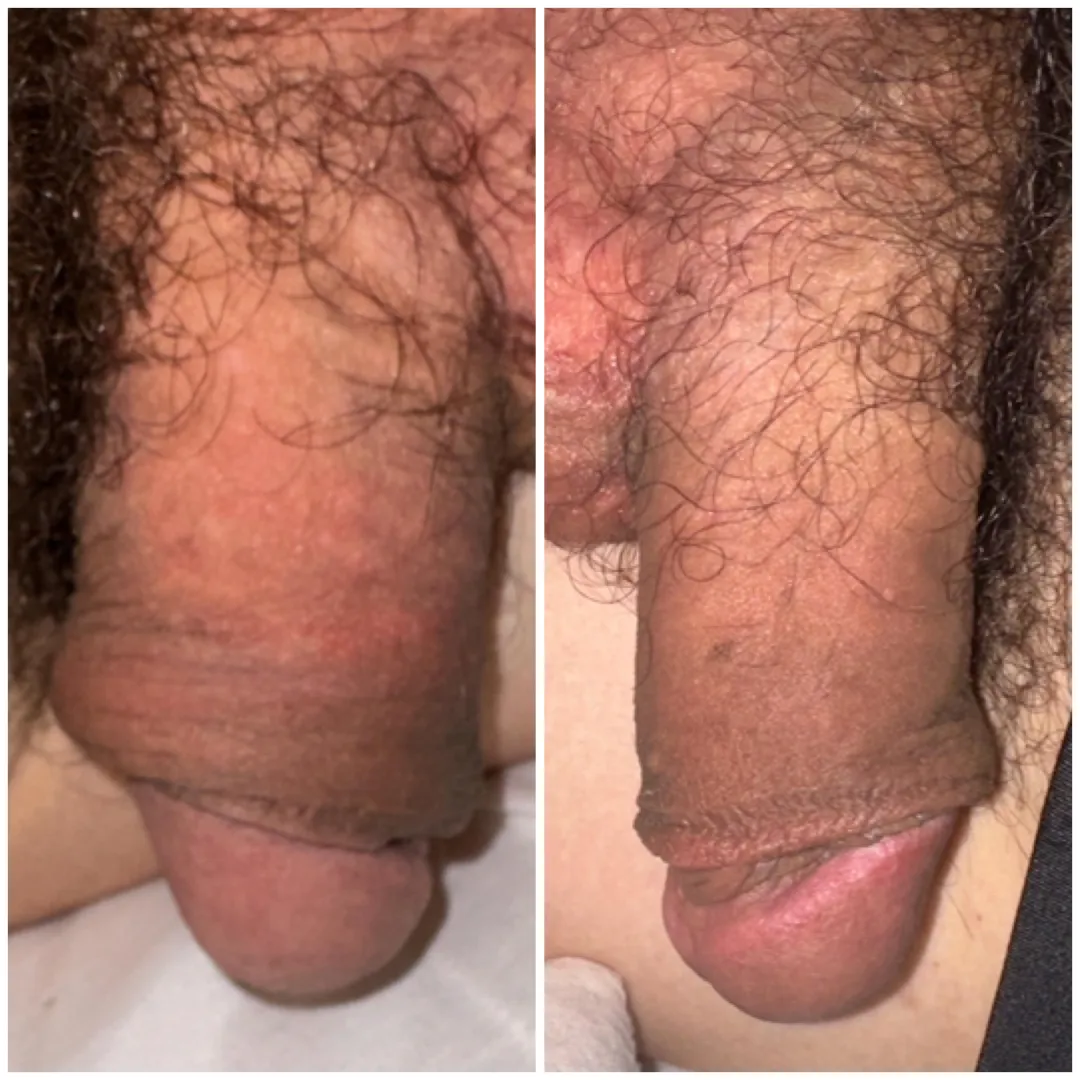 Is this progress good for just under 6 months ?