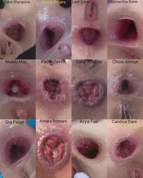 I've never understood men who choose tits over ass, are you saying you would rather suck on some boring tasteless nipples and not some hot juicy gape with flesh inside it and the fact that shit comes out of it makes it 100 times better. It's just prima