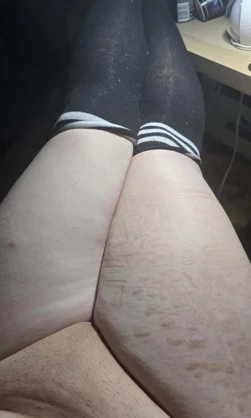 Just legs