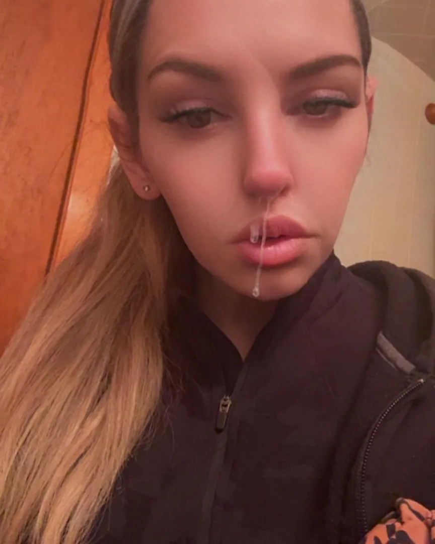 Just some snot with your lunch 