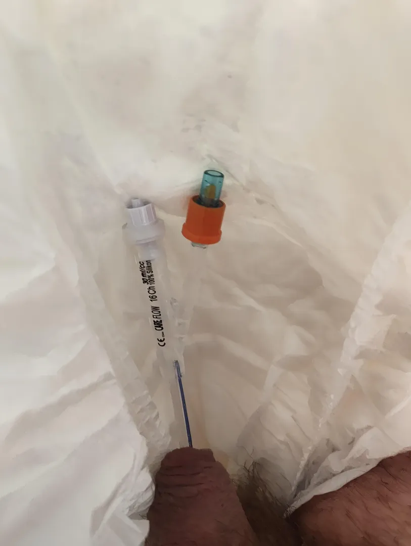 Lazy Sunday with catheter and daiper