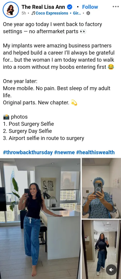 Lisa Ann before and after