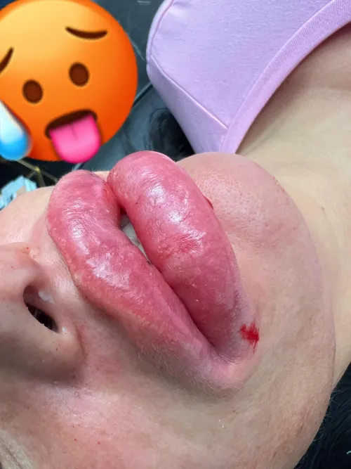 Live heute Abend 20 uhr mit neuen dicken Lippen