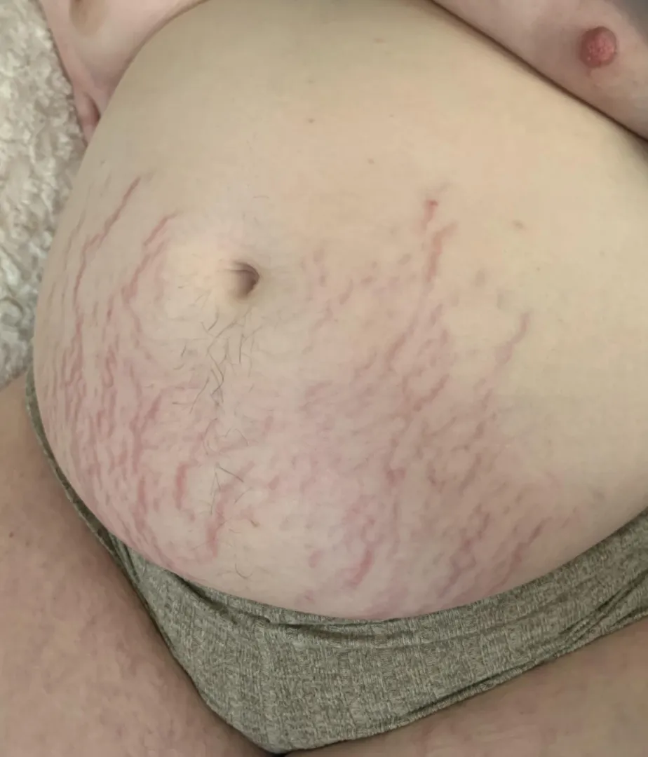 Look at how ripped up I am from being a big fat pig