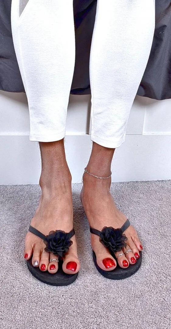 Love these flip flops