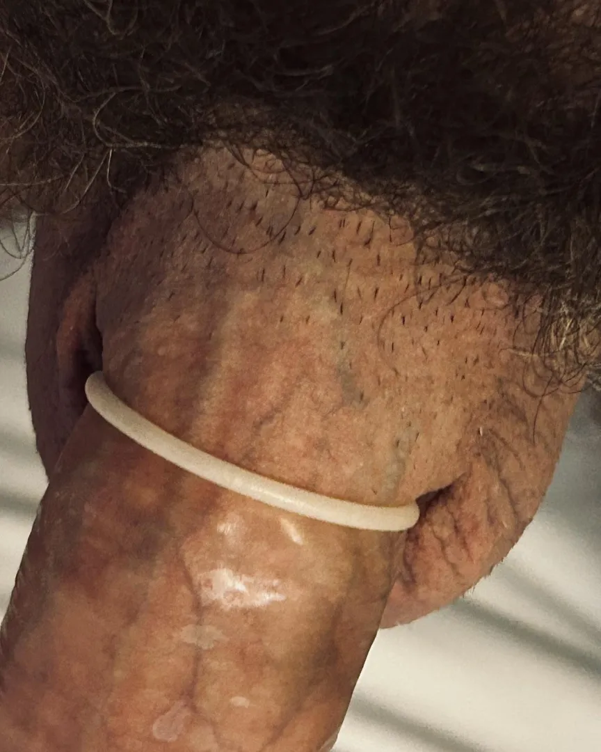 [M] I wear king size or XL rubbers and they're *still* too tight on my dickshaft...