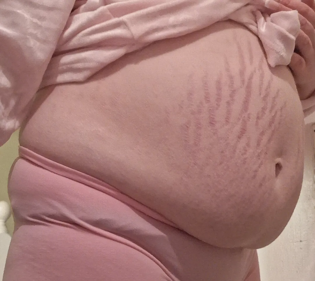 My bellys really showing ;3