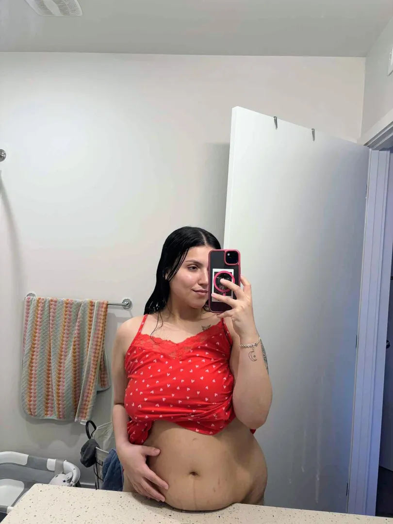 My growing tummy is gaining stretchies