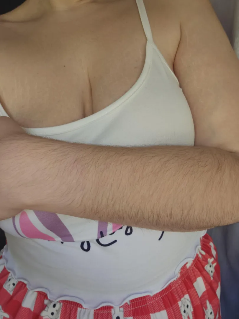 My Hairy [arms] natural