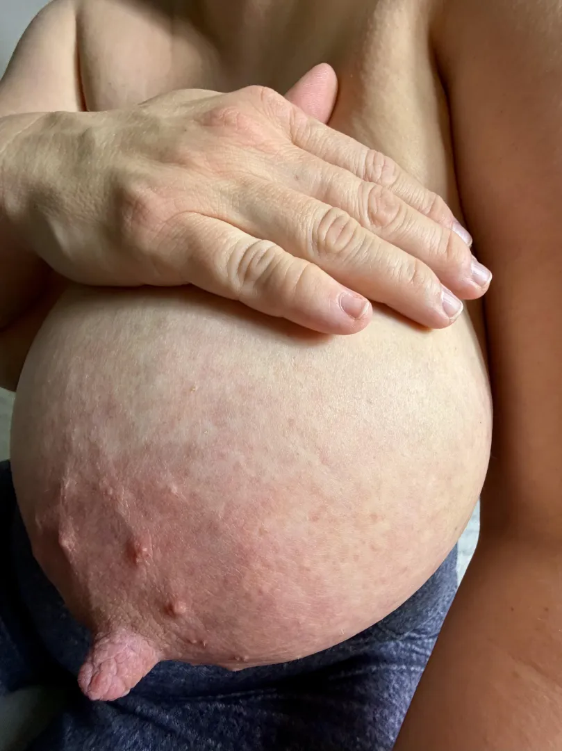 My little finger vs the nipple