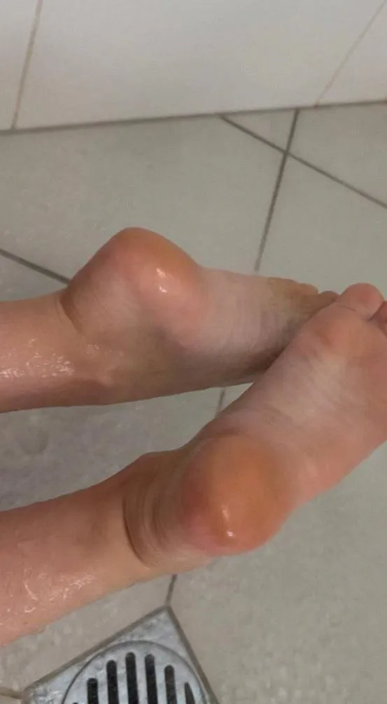 My soles need your attention