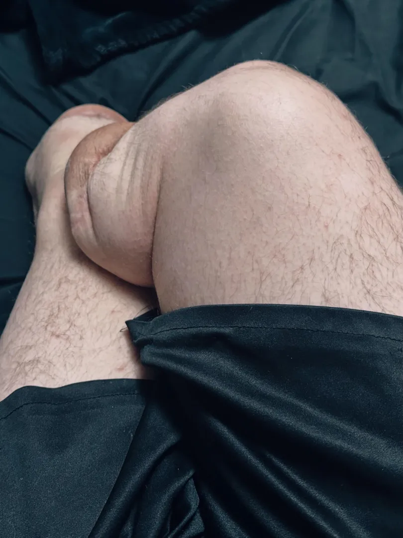 My stumps jiggle so much 