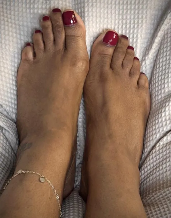 Natural barefeet on a slow Saturday...