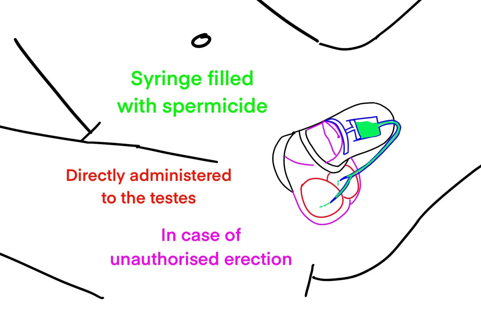 New chastity prototype. Would you sign up for the trial?