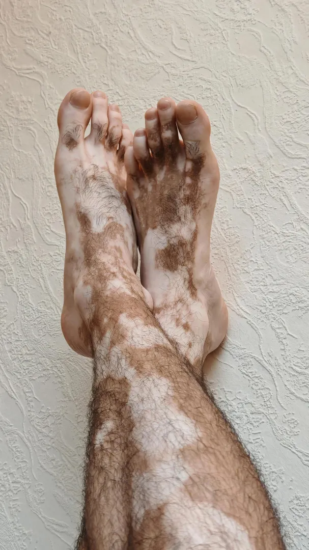 Not a tattoo. Just rare geometry 