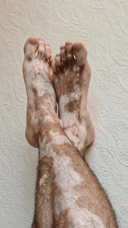 Not a tattoo. Just rare geometry 