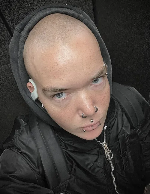 Not your typical bald girl