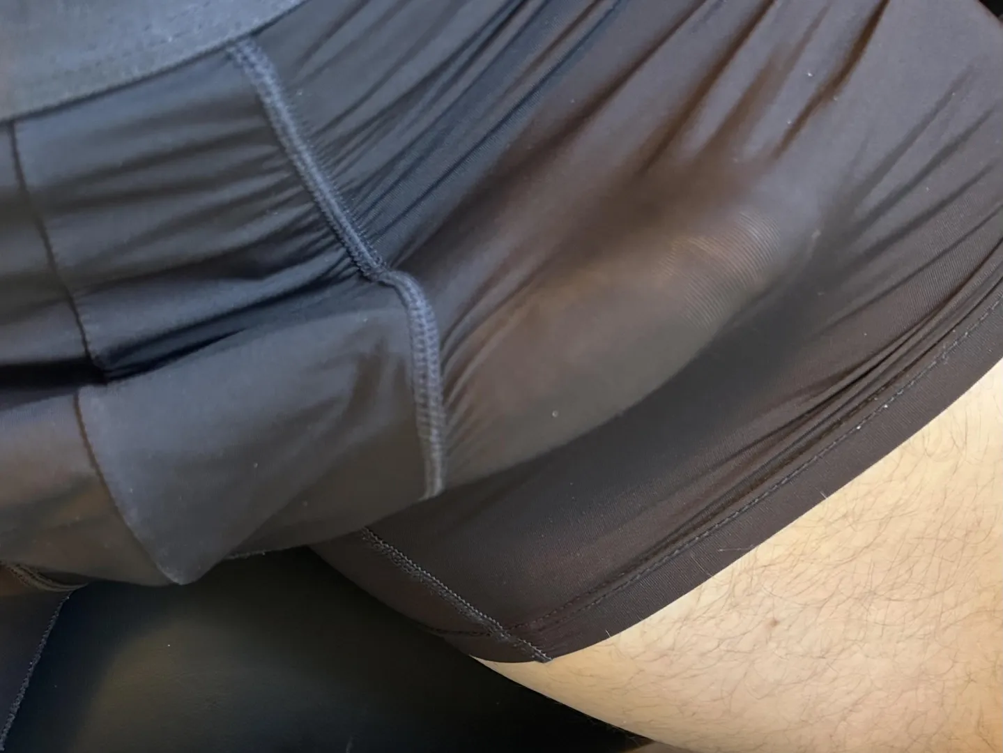 Office bulge (35)