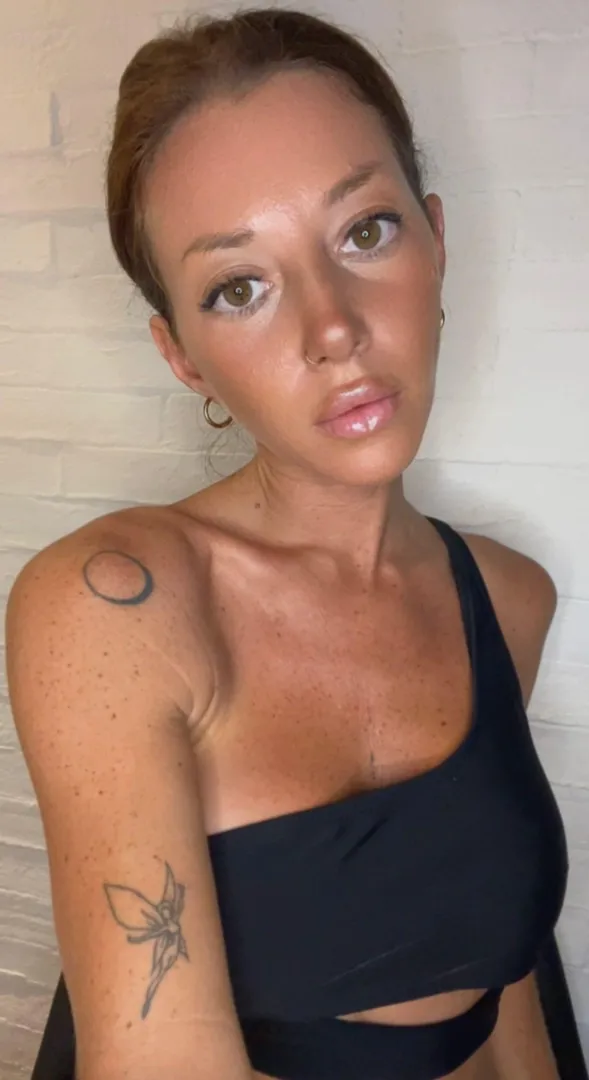 one freckle = one kiss