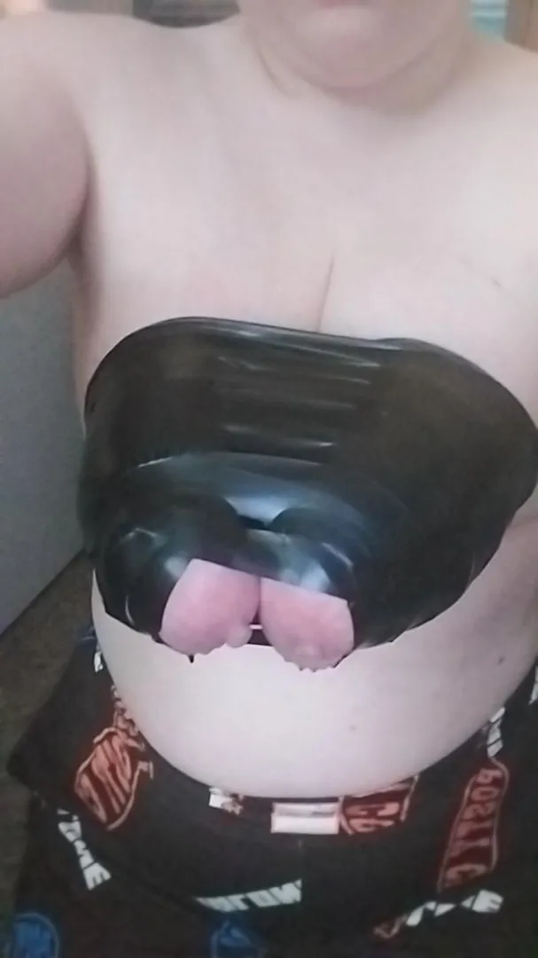 Only way you can even tell they're tits anymore is by the nipples poking out