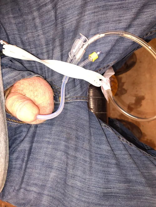 Oops I am doing it again