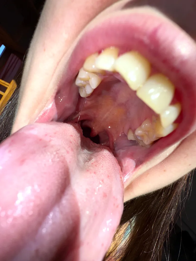 open enough for you?