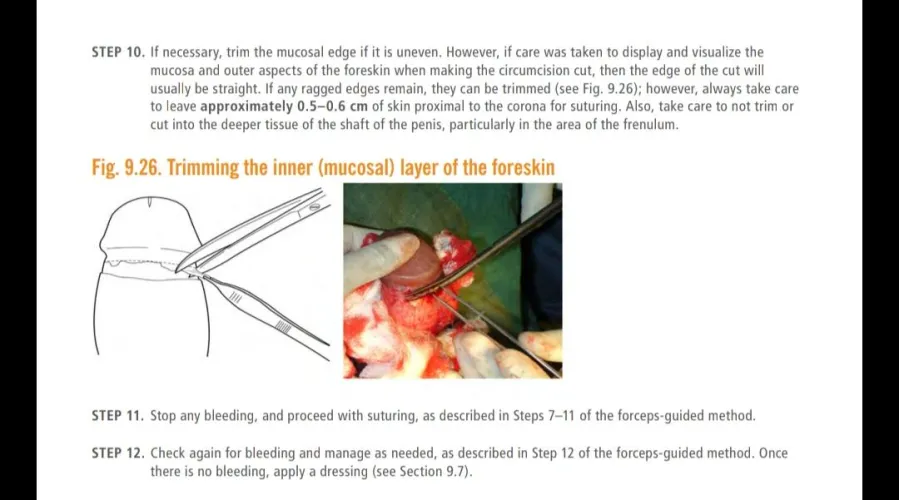 Optional Step 10 takes us here