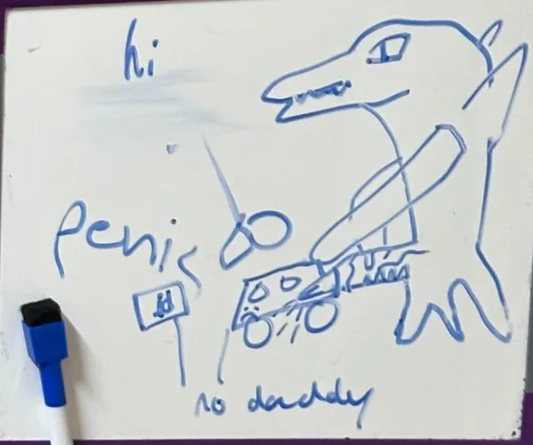 Penis