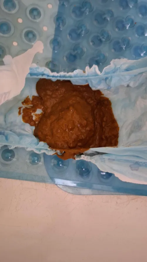 Poopy mess in luvs