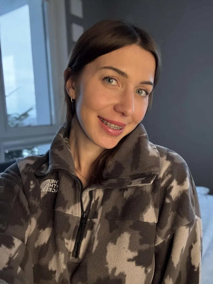 P.O.V: You finally get the girl with braces